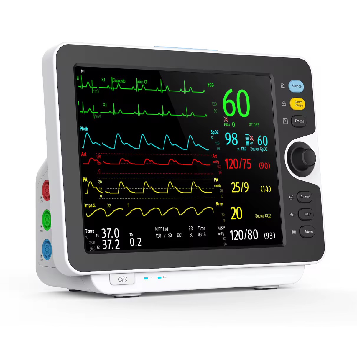 vital sign monitor suppliers in Nigeria by Scantrik